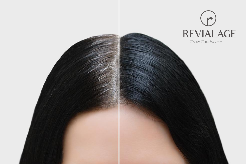 Revialage's Top Tips for Maintaining a Healthy Scalp